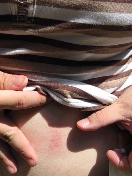 學前總統也來張肥肚仔驗傷照 學前總統也來張肥肚仔驗傷照