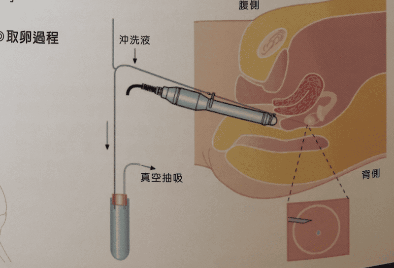 螢幕快照 2018-02-04 上午1.23.06.png 螢幕快照 2018-02-04 上午1.23.06.png